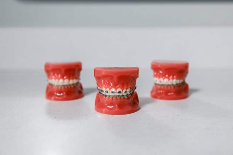 sample of braces Greg Brown Orthodontics