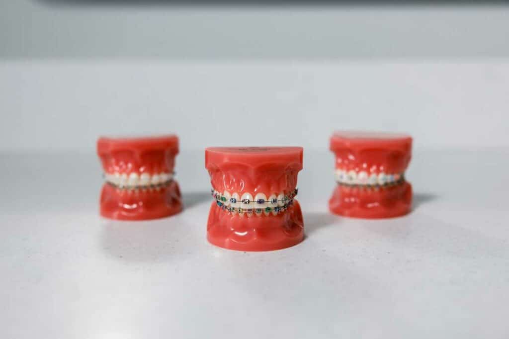 traditional braces Greg Brown Orthodontics
