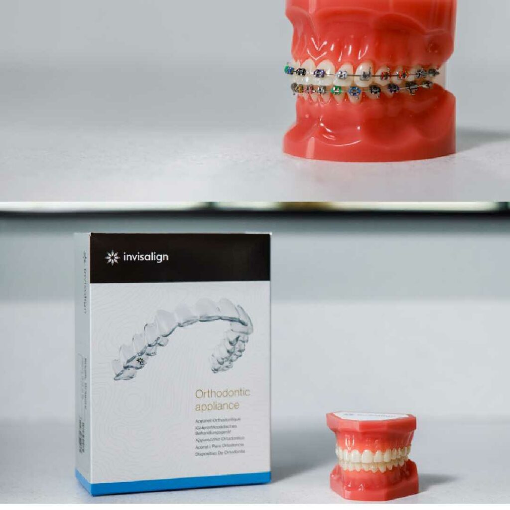 traditional braces vs invisalign by Greg Brown Orthodontics