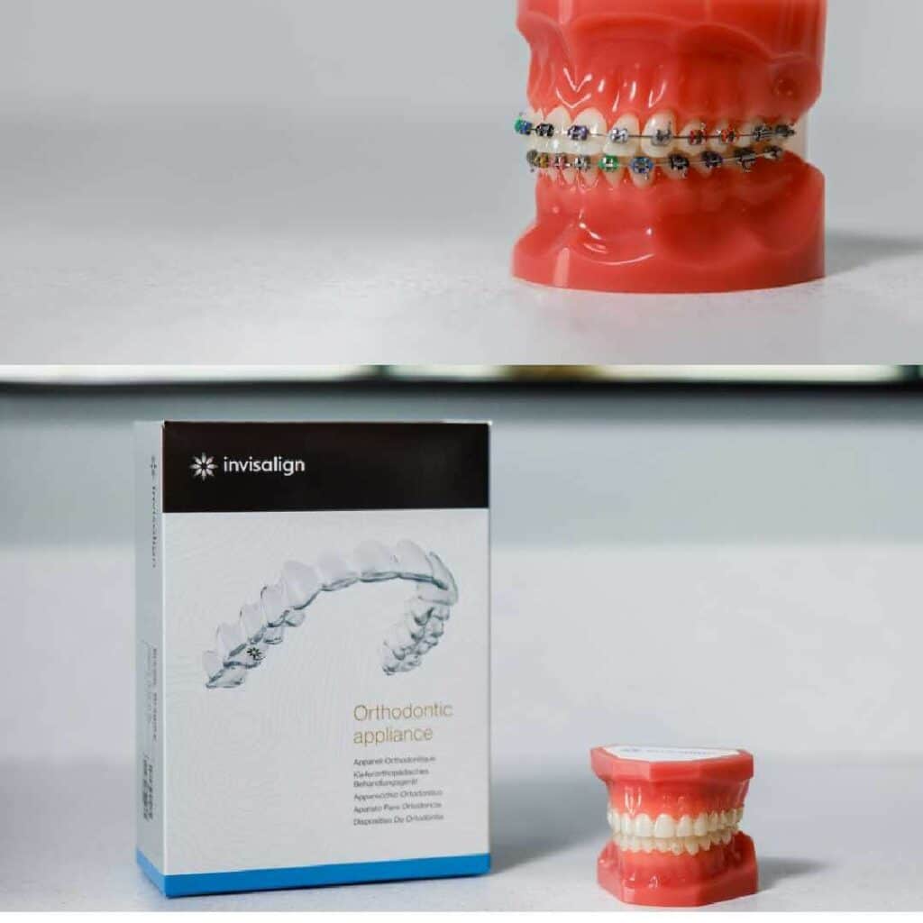 a photo of Invisalign and traditional braces Greg Brown Orthodontics