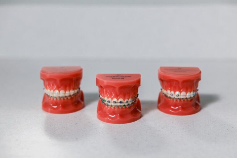 three sets of model braces on false teeth